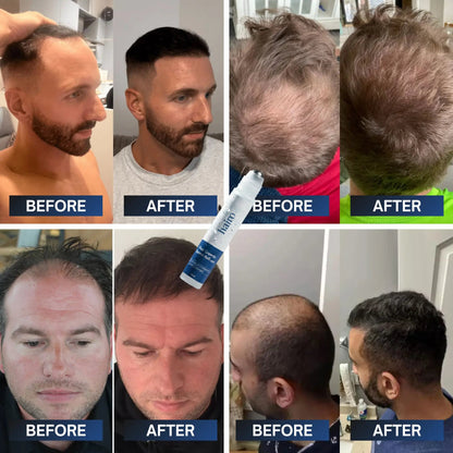 Advanced Hair Growth Roll-On Serum